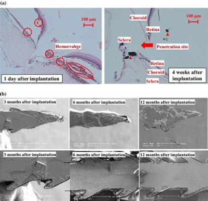 シルイコンゲル：再生医療における柔軟性と生体適合性の驚異！